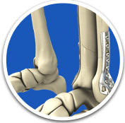  Fracture and Trauma - Orthopaedic Surgical Specialist