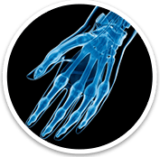  Hand And Wrist - Orthopaedic Surgical Specialist