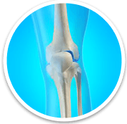 Knee - Orthopaedic Surgical Specialist