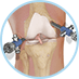 Arthoscopy Surgery - Orthopaedic Surgical Specialist
