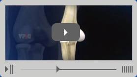 Multimedia Education Video - Orthopaedic Surgical Specialist