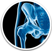 Hip - Orthopaedic Surgical Specialist